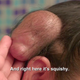 Image for article titled Bada Bing, Dr. Pimple Popper Meets Bada Boob